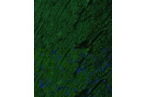 Immunofluorescence analysis of mouse heart cells using TNNI3 antibody (ABIN6132730, ABIN6149358, ABIN6149360 and ABIN6222761) at dilution of 1:100. (TNNI3 抗体  (AA 1-210))