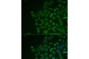 Immunofluorescence analysis of MCF7 cells using LRat Polyclonal Antibody (LRAT 抗体)