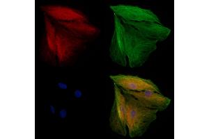 ABIN6263679 and ABIN6272969 staining  cells by IF/ICC.