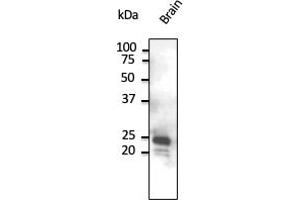 Western Blotting (WB) image for anti-RAB9B, Member RAS Oncogene Family (RAB9B) (C-Term) antibody (ABIN1440002) (RAB9B 抗体  (C-Term))