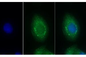 Detection of EDN1 in Human Hela cell using Monoclonal Antibody to Endothelin 1 (EDN1) (Endothelin 1 抗体  (AA 53-203))