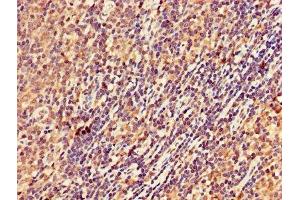 IHC image of ABIN7168978 diluted at 1:300 and staining in paraffin-embedded human lymph node tissue performed on a Leica BondTM system. (DRAK2 抗体  (AA 235-366))