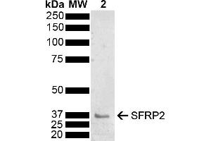 Western blot analysis of Mouse Brain showing detection of 33. (SFRP2 抗体  (AA 195-295) (HRP))