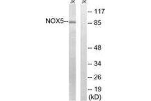 Western blot analysis of extracts from Jurkat cells, using NOX5 Antibody.