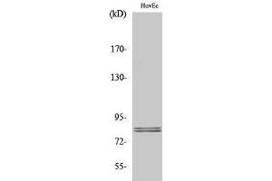 Western Blotting (WB) image for anti-Lipase, Hormone-Sensitive (LIPE) (Ser774) antibody (ABIN3185095) (LIPE 抗体  (Ser774))