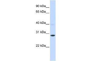PGAM2 antibody used at 1 ug/ml to detect target protein. (PGAM2 抗体)
