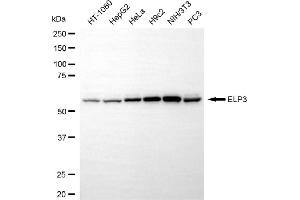 Western blotting analysis using ELP3 antibody (ABIN7798434). (Recombinant ELP3/KAT9 抗体)