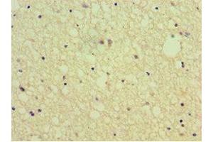 Immunohistochemistry of paraffin-embedded human brain tissue using ABIN7168802 at dilution of 1:100