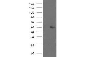 Western Blotting (WB) image for anti-Aldolase B, Fructose-Bisphosphate (ALDOB) antibody (ABIN1496606) (ALDOB 抗体)