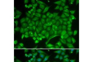 Immunofluorescence analysis of MCF-7 cells using RAB11A Polyclonal Antibody (RAB11A 抗体)