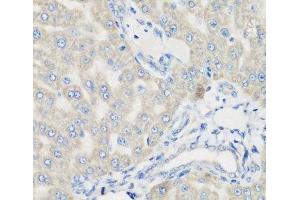 Immunohistochemistry of paraffin-embedded Rat liver using PYCR1 Polyclonal Antibody at dilution of 1:200 (40x lens). (PYCR1 抗体)