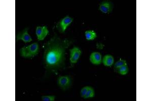 Immunofluorescence staining of MCF-7 cells with ABIN7167068 at 1:200, counter-stained with DAPI.
