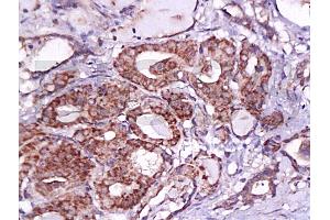 Immunohistochemistry (IHC) image for anti-V-Set Domain Containing T Cell Activation Inhibitor 1 (VTCN1) (AA 50-100) antibody (ABIN671736)