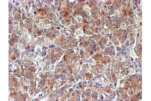 Image no. 3 for anti-NADH Dehydrogenase (Ubiquinone) Complex I, Assembly Factor 7 (NDUFAF7) antibody (ABIN1499667) (NDUFAF7 抗体)