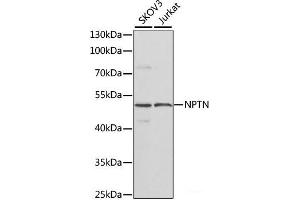Western blot analysis of extracts of various cell lines using NPTN Polyclonal Antibody at dilution of 1:1000. (NPTN 抗体)