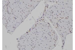 ABIN6277194 at 1/100 staining Human gastric tissue by IHC-P. (Histone 3 抗体  (H3K4me3))