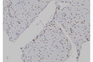 ABIN6277194 at 1/100 staining Human gastric tissue by IHC-P.