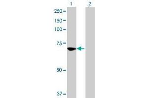 Western Blotting (WB) image for CPT2 293T Cell Transient Overexpression Lysate(Denatured) (ABIN1331417)