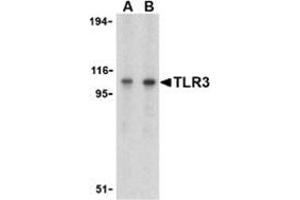 Western blot analysis of TLR3 in Daudi cell lysate with CD283 / TLR3 antibody at (A) 1 and (B) 2 μg/ml. (TLR3 抗体  (C-Term))