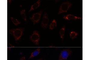 Immunofluorescence analysis of L929 cells using TBRG4 Polyclonal Antibody at dilution of 1:100. (TBRG4 抗体)