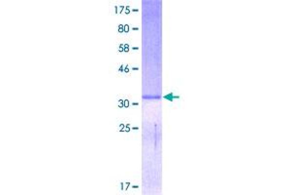 DEFA5 Protein (AA 1-94) (GST tag)
