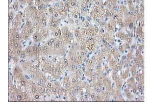 Immunohistochemical staining of paraffin-embedded Human liver tissue using anti-NIT2 mouse monoclonal antibody.