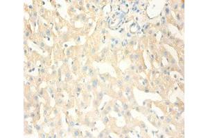 Immunohistochemistry of paraffin-embedded human liver tissue using ABIN7159537 at dilution of 1:100 (MT1X 抗体  (AA 1-59))