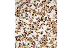 Immunohistochemistry (IHC) image for anti-Ets Variant 6 (ETV6) antibody (ABIN3003964) (ETV6 抗体)
