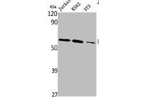 Western Blot analysis of Jurkat K562 NIH-3T3 cells using PLK-5 Polyclonal Antibody (PLK5 抗体  (Internal Region))