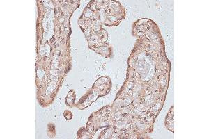 Immunohistochemistry of paraffin-embedded human placenta using TLK1 antibody (ABIN7270859) at dilution of 1:100 (40x lens). (TLK1 抗体  (AA 160-230))