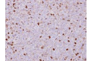 Immunohistochemistry (IHC) image for anti-Rac GTPase Activating Protein 1 (RACGAP1) (N-Term) antibody (ABIN2856889)