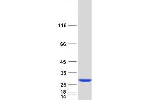 Western Blotting (WB) image for ADP-Ribosylation Factor-Like 11 (ARL11) protein (Myc-DYKDDDDK Tag) (ABIN2714903)
