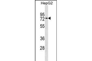 ZN Antibody (Center) (ABIN1537955 and ABIN2849970) western blot analysis in HepG2 cell line lysates (35 μg/lane). (ZNF614 抗体  (AA 174-200))