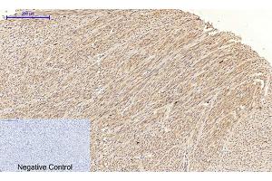 Immunohistochemical analysis of paraffin-embedded human uterus tissue. (JNK 抗体  (pThr183))