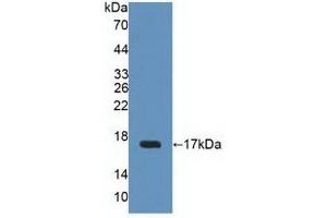 Western blot analysis of recombinant Human UPK2. (Uroplakin 2 抗体  (AA 26-153))