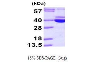 SDS-PAGE (SDS) image for Pyridoxal Kinase (PDXK) (AA 1-312) protein (His tag) (ABIN667835) (PDXK Protein (AA 1-312) (His tag))