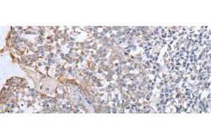 Immunohistochemistry of paraffin-embedded Human tonsil tissue using GPD2 Polyclonal Antibody at dilution of 1:40(x200) (GPD2 抗体)