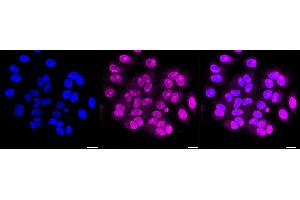 Immunocytochemical staining of HepG2 cells with Carbonic Anhydrase 9 antibody (ABIN7797869), 1:1,000). (Recombinant CA9 抗体)