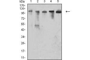 Western blot analysis using CD106 mouse mAb against EC (1), COS7 (2), MCF-7 (3), HepG2 (4), and Hela (5) cell lysate. (VCAM1 抗体  (AA 25-183))