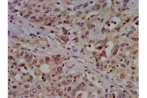 Immunohistochemistry (IHC) image for anti-Solute Carrier Family 7 (Cationic Amino Acid Transporter, Y+ System), Member 1 (SLC7A1) (AA 430-492) antibody (ABIN7155172)