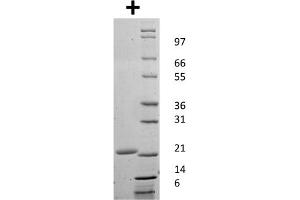 SDS-PAGE of Mouse Granulocyte Colony Stimulating Factor Recombinant Protein SDS-PAGE of Mouse Granulocyte Colony Stimulating Factor Recombinant Protein. (G-CSF 蛋白)
