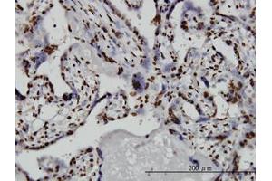 Image no. 4 for anti-TATA Box Binding Protein Associated Factor 11 (TAF11) (AA 158-211) antibody (ABIN598957) (TAF11 抗体  (AA 158-211))