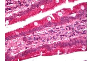 Anti-GUCY1A3 / Guanylyl Cyclase Alpha 1 antibody IHC of human small intestine. (GUCY1A1 抗体)