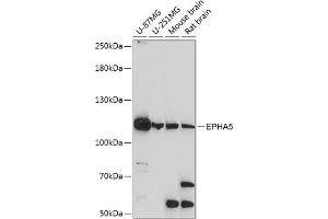 Western blot analysis of extracts of various cell lines, using EPH antibody (ABIN7266971) at 1:1000 dilution. (EPH Receptor A5 抗体  (AA 1-130))