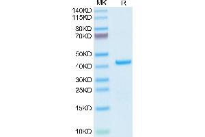 AIMP1 Protein (AA 2-312) (His tag)