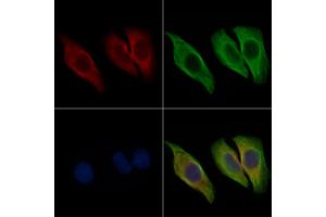 ABIN6265399 and ABIN6267024 staining Hela cells by IF/ICC. (SDC4 抗体  (C-Term))