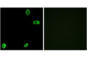 Immunofluorescence analysis of A549 cells, using TAS2R39 Antibody. (TAS2R39 抗体  (AA 218-267))