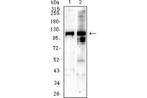 Western blot analysis using SALL4 mouse mAb against NIH/3T3 (1) C2C12 (2) cell lysate. (SALL4 抗体  (AA 96-359))