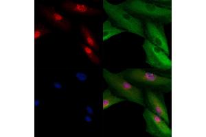 ABIN6260755 and ABIN6278972 staining  cells by IF/ICC. (CENPH 抗体  (N-Term))