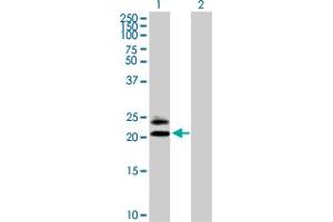 Western Blot analysis of MS4A5 expression in transfected 293T cell line by MS4A5 MaxPab polyclonal antibody. (MS4A5 抗体  (AA 1-200))